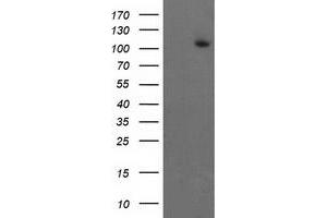Western Blotting (WB) image for anti-Excision Repair Cross-Complementing Rodent Repair Deficiency, Complementation Group 4 (ERCC4) antibody (ABIN1498072) (ERCC4 anticorps)