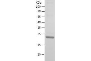 Western Blotting (WB) image for Glucose-6-Phosphate Isomerase (GPI) (AA 357-558) protein (His tag) (ABIN7123106)