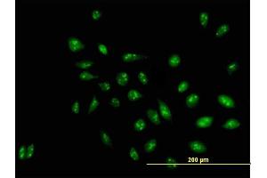 Immunofluorescence of purified MaxPab antibody to D21S2056E on HeLa cell. (RRP1 anticorps  (AA 1-461))