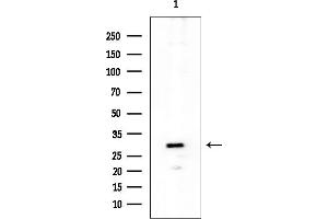 anti-Polycomb Group Ring Finger 1 (PCGF1) antibody