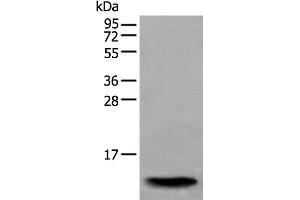 Western blot analysis of Human normal stomach tissue lysate using SAA4 Polyclonal Antibody at dilution of 1:350 (SAA4 anticorps)