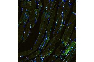 IF analysis of Laminin using anti-Laminin antibody (ABIN5692889).