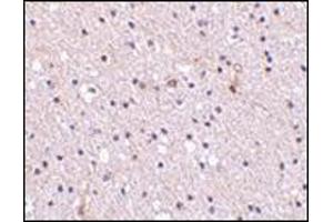 Immunohistochemistry of Nicastrin in human brain tissue with this product at 2. (Nicastrin anticorps  (Center))