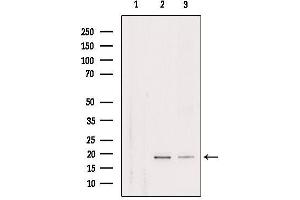 Western blot analysis of extracts from various samples, using RPL29 Antibody.