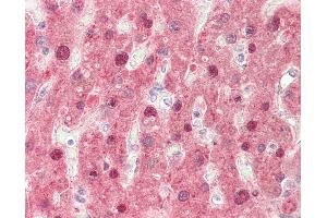 Human, Liver: Formalin-Fixed Paraffin-Embedded (FFPE).