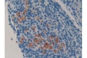 Detection of LCN8 in Mouse Ovary Tissue using Polyclonal Antibody to Lipocalin 8 (LCN8)