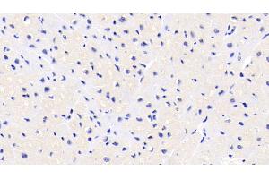 Detection of FKBP1A in Human Cardiac Muscle Tissue using Monoclonal Antibody to FK506 Binding Protein 1A (FKBP1A)