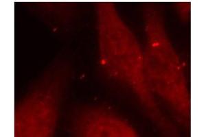 Immunofluorescence analysis of methanol-fixed HeLa cells using Phospho-ABL1(Y412) Polyclonal Antibody (ABL1 anticorps  (pTyr412))