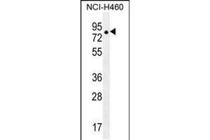 Western blot analysis in NCI-H460 cell line lysates (35ug/lane). (ZFP28 anticorps  (N-Term))
