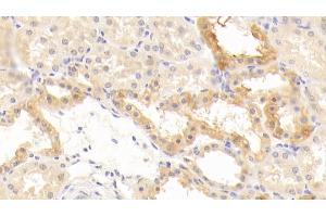 Detection of CD40L in Human Kidney Tissue using Polyclonal Antibody to Cluster Of Differentiation 40 Ligand (CD40L) (CD40 Ligand anticorps  (AA 1-261))