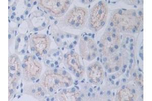 anti-Complement Factor D (CFD) (AA 1-263) antibody