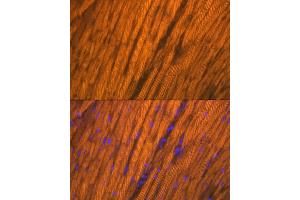 Immunofluorescence analysis of rat heart using  Rabbit mAb (ABIN7265397) at dilution of 1:100 (40x lens). (ACTN2 anticorps)