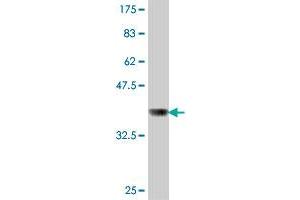Western Blot detection against Immunogen (37 KDa) .