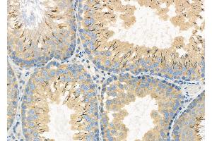 ABIN6261581 and ABIN6272294 at 1/100 staining Rat testis tissue by IHC-P. (EPS8-Like 3 anticorps)