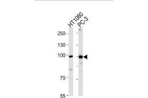 Western Blotting (WB) image for anti-Zinc Finger Protein 560 (ZNF560) antibody (ABIN3004763) (ZNF560 anticorps)