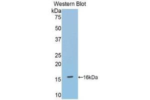 Western Blotting (WB) image for anti-Debranching Enzyme Homolog 1 (DBR1) (AA 133-241) antibody (ABIN1858612) (DBR1 anticorps  (AA 133-241))