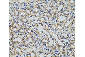 Immunohistochemistry of paraffin-embedded Rat kidney using TRMT2A Polyclonal Antibody at dilution of 1:100 (40x lens). (TRMT2A anticorps)