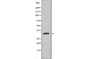 Western blot analysis of extracts from HeLa cells using ATPG antibody.