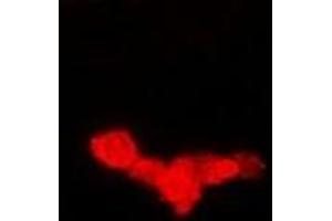 Immunofluorescent analysis of EEF1A1 staining in Hela cells.