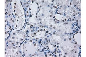 Immunohistochemical staining of paraffin-embedded prostate tissue using anti-PSMA7mouse monoclonal antibody. (PSMA7 anticorps)