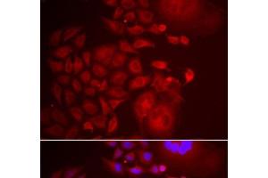 Immunofluorescence analysis of U2OS cells using TRAPPC10 Polyclonal Antibody (TRAPPC10 anticorps)