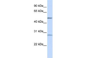 WB Suggested Anti-ZNF141 Antibody Titration:  0.