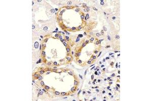 staining EGF in Human kidney tissue sections by Immunohistochemistry (IHC-P - paraformaldehyde-fixed, paraffin-embedded sections). (EGF anticorps  (Center))