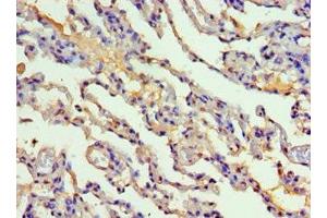 Immunohistochemistry of paraffin-embedded human lung tissue using ABIN7149252 at dilution of 1:100 (CYP2F1 anticorps  (AA 100-290))