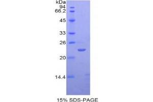 SDS-PAGE analysis of Human SIGLEC12 Protein. (SIGLEC12 Protéine)