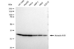 anti-Annexin A10 (ANXA10) antibody