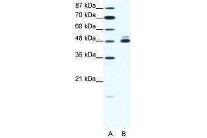 CHRNB2 antibody (20R-1324) used at 2. (CHRNB2 anticorps  (N-Term))