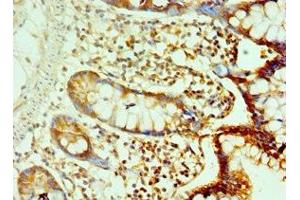 Immunohistochemistry of paraffin-embedded human small intestine tissue using ABIN7146219 at dilution of 1:100 (LI Cadherin anticorps  (AA 573-832))