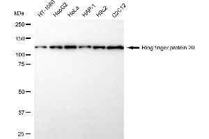 anti-Ring Finger Protein 20 (RNF20) antibody