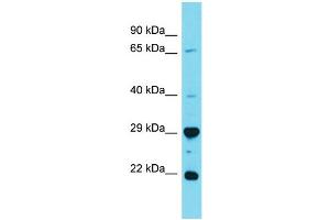 Western Blotting (WB) image for anti-HAUS Augmin-Like Complex, Subunit 2 (HAUS2) (N-Term) antibody (ABIN2791572)
