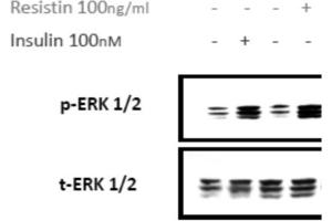 SDS-PAGE of Human Resistin Dimer Recombinant Protein Bioactivity of Human Resistin Dimer Recombinant Protein.