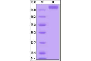 Mouse VEGF R2, Mouse IgG2a Fc Tag, low endotoxin on  under reducing (R) condition.