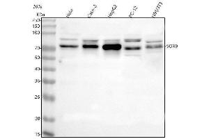 Western blot analysis of SOX9 using anti-SOX9 antibody (ABIN7599444).