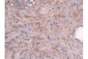 Detection of Kim1 in Human Prostate Gland Tissue using Monoclonal Antibody to Kidney Injury Molecule 1 (Kim1)