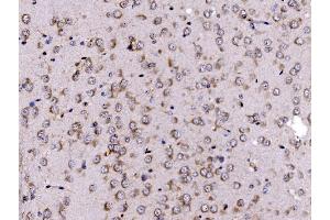 IHC analysis of FKBP135/FKBP15 using anti-FKBP135/FKBP15 antibody (ABIN7600397).