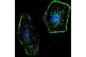 Fluorescent confocal image of SY5Y cells stained with ERAS (F66) antibody. (ERAS anticorps  (N-Term))