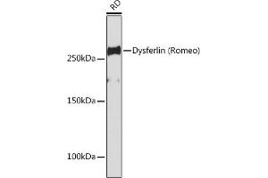 Western blot analysis of extracts of RD cells, using Dysferlin (Romeo) Rabbit mAb (ABIN7266868) at 1:1000 dilution. (Dysferlin anticorps)