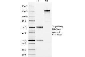 SDS-PAGE Analysis Purified HLA-DP/DR Mouse Monoclonal Antibody (Bra-14). (HLA-DPB1 & HLA-DRA anticorps)