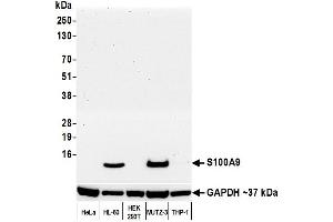 Western Blotting (WB) image for anti-S100 Calcium Binding Protein A9 (S100A9) (AA 64-114) antibody (ABIN7449432)