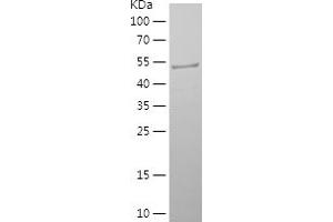Western Blotting (WB) image for Phosphoglucomutase 2 (PGM2) (AA 167-366) protein (His-IF2DI Tag) (ABIN7124411)
