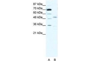 Western Blotting (WB) image for anti-Cholinergic Receptor, Nicotinic, alpha 3 (Neuronal) (CHRNA3) antibody (ABIN2463738) (CHRNA3 anticorps)