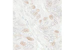 Immunohistochemistry (IHC) image for anti-Cell Division Cycle 20 Homolog (S. Cerevisiae) (CDC20) (AA 50-100) antibody (ABIN7448465) (CDC20 anticorps  (AA 50-100))