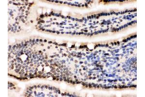 IHC analysis of Lamin B1 using anti-Lamin B1 antibody .