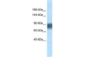 WB Suggested Anti-Avil Antibody Titration: 1. (Advillin anticorps  (N-Term))