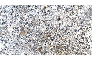 IHC analysis of DRP1/DNM1L using anti-DRP1/DNM1L antibody (ABIN7602180). (Dynamin 1-Like anticorps  (AA 618-736))