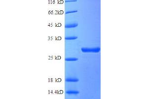 SDS-PAGE (SDS) image for Adrenergic, Beta, Receptor Kinase 1 (ADRBK1) (AA 2-634), (partial) protein (His tag) (ABIN5712097)